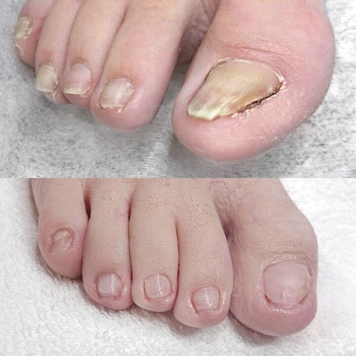 Σχόλια από τη χρήση Keramin